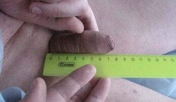Medición del tamaño del pene